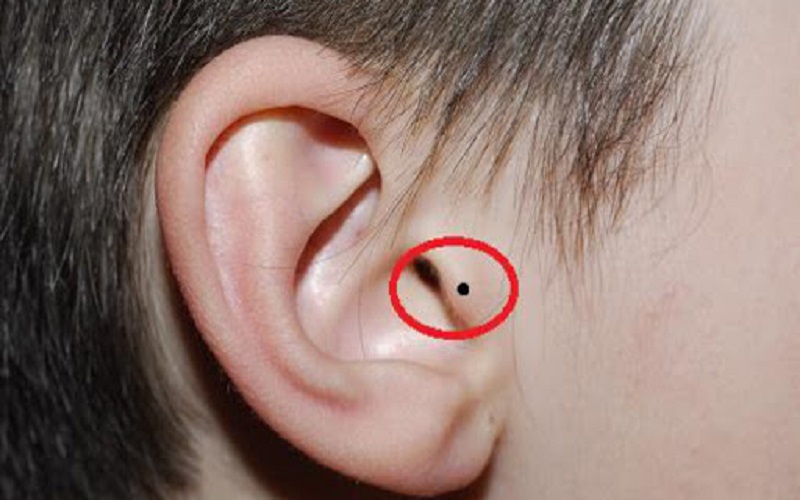 Nốt ruồi bên tai phải là người có tình duyên may mắn